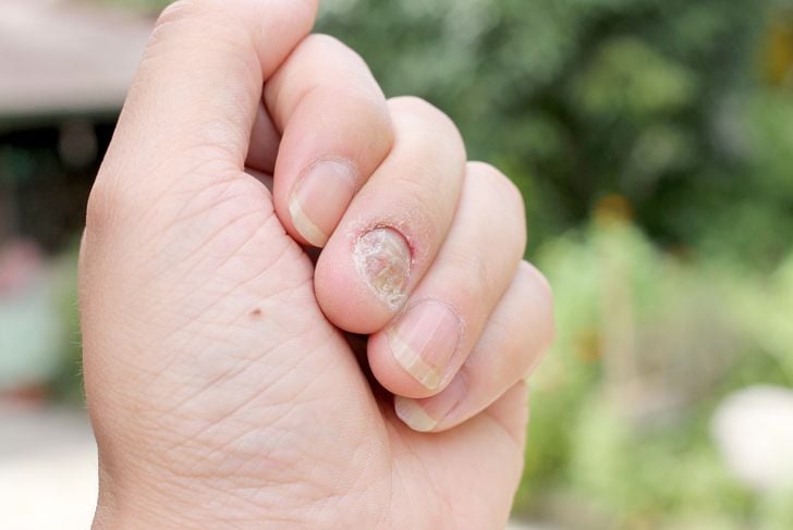 10 cose inquietanti che le unghie rivelano sulla vostra salute 1