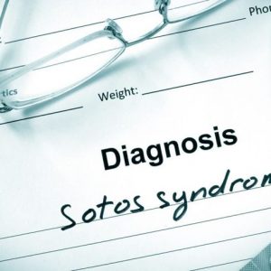 Che cos’è la sindrome di Sotos?