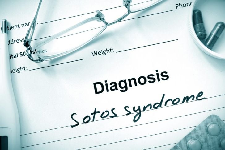 Che cos'è la sindrome di Sotos? 1