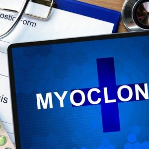 Sintomi, cause e trattamento del mioclono