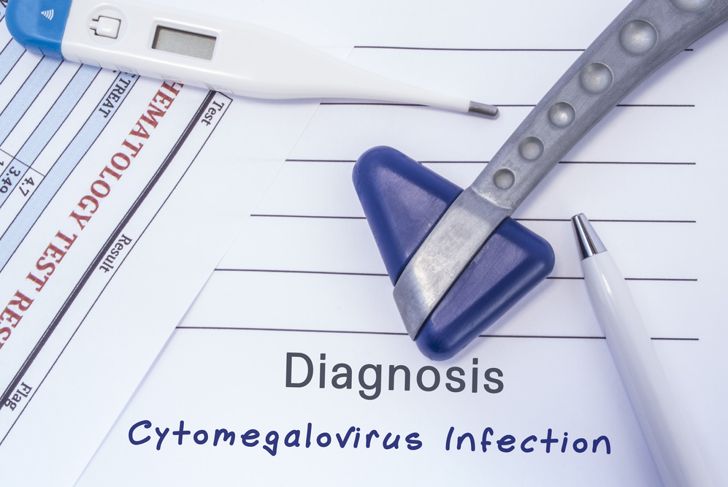 10 sintomi del citomegalovirus (CMV) 3