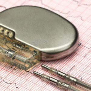 Vivere con un pacemaker Vivere con un pacemaker