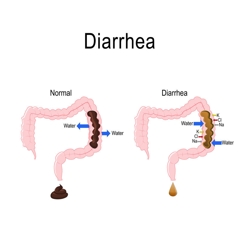 Diarrea 1