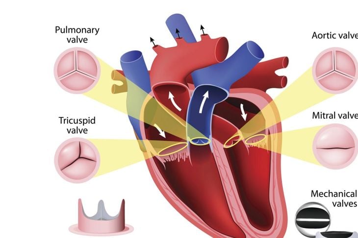Che cos'è l'insufficienza della valvola aortica? 3