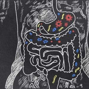 Capire la gastroparesi Capire la gastroparesi
