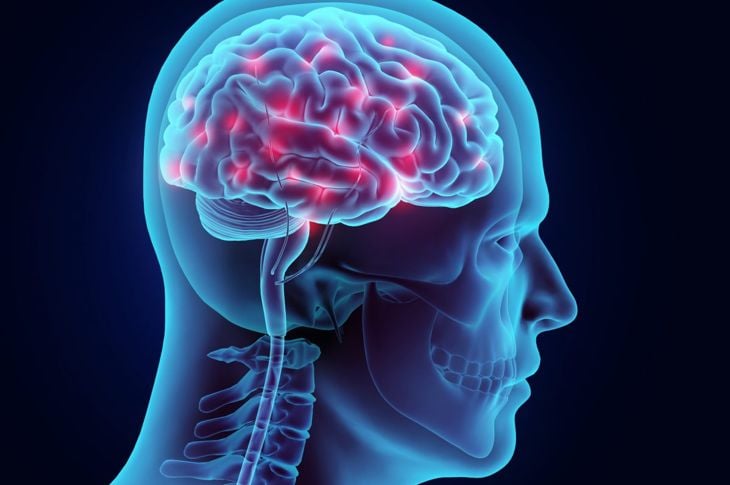 Idrocefalo: eccesso di liquido cerebrospinale nel cervello 9