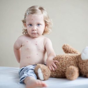 Cosa causa l’herpes zoster? Cosa causa l’herpes zoster?
