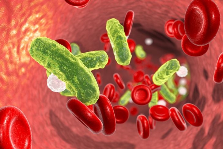 11 sintomi di infezione batterica 13