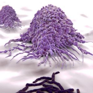 10 fatti importanti sull’infiammazione granulomatosa