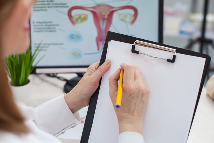 10 domande frequenti sui polipi uterini 15