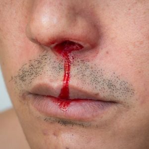 10 segni di ipertensione 10 segni di ipertensione
