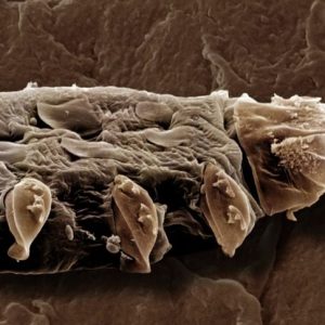 Cosa sono gli acari Demodex? Cosa sono gli acari Demodex?