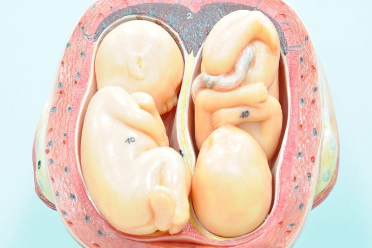 Il significato della posizione del feto 13
