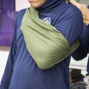 10 segni della sindrome di Ehlers-Danlos 10 segni della sindrome di Ehlers-Danlos