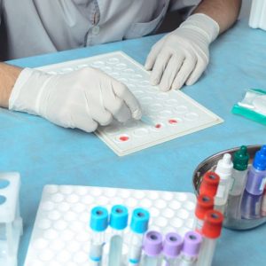 Diagnosi e trattamento dell’incompatibilità Rh Diagnosi e trattamento dell’incompatibilità Rh