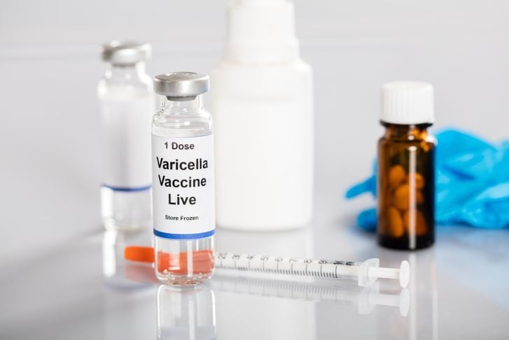 Che cos'è la varicella? Sintomi e trattamento 19