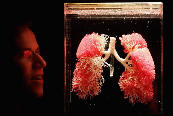 Che cos'è la polmonite da aspirazione? 17