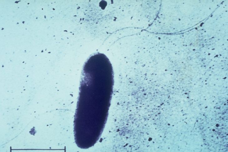 Batteri patogeni e benefici dello Pseudomonas 15