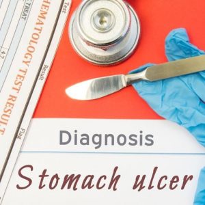10 trattamenti popolari per l’ulcera allo stomaco
