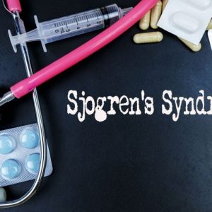 Sintomi e trattamenti della sindrome di Sjogren Sintomi e trattamenti della sindrome di Sjogren