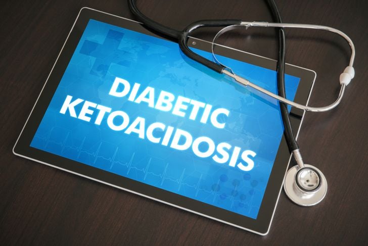 10 Sintomi e trattamenti della chetoacidosi diabetica 5