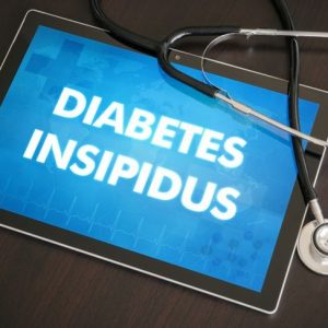 10 domande frequenti sul diabete insipido
