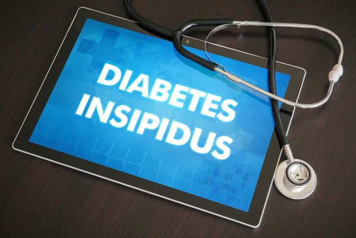 10 domande frequenti sul diabete insipido 1