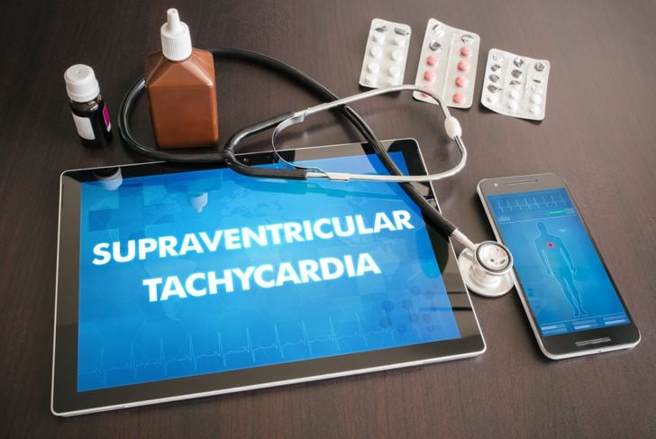 Che cos'è la tachicardia sopraventricolare? 10 Sintomi e trattamenti 13
