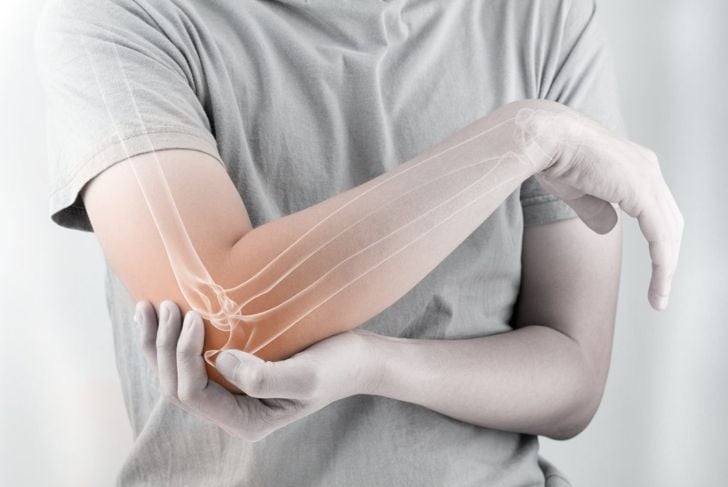 Qual è la differenza tra artrite reumatoide e gotta? 3