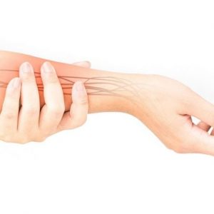 10 fatti sull’intrappolamento del nervo ulnare