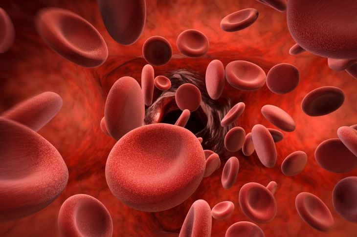 Tipi di anemia microcitica 1