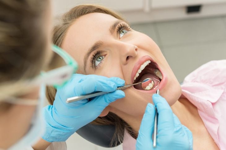 Lo sbiancamento dei denti è sicuro ed efficace? 5