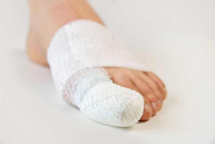 Cose da sapere sulle dita dei piedi rotte 1