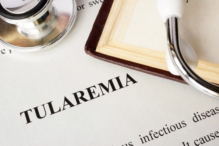 Quali sono le cause, i sintomi e i trattamenti della tularemia? 1