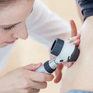 10 segni di cancro della pelle 10 segni di cancro della pelle
