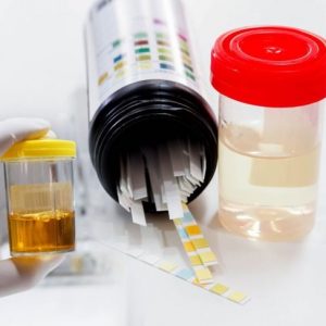 Domande frequenti sull’ematuria microscopica Domande frequenti sull’ematuria microscopica