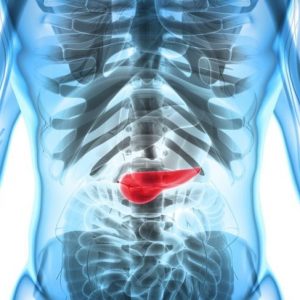 Domande frequenti sulla pancreatite acuta Domande frequenti sulla pancreatite acuta