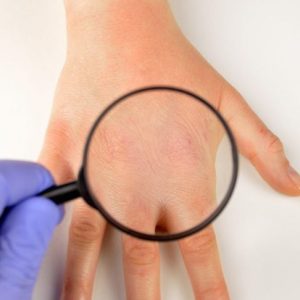 10 domande frequenti sulla rottura delle nocche