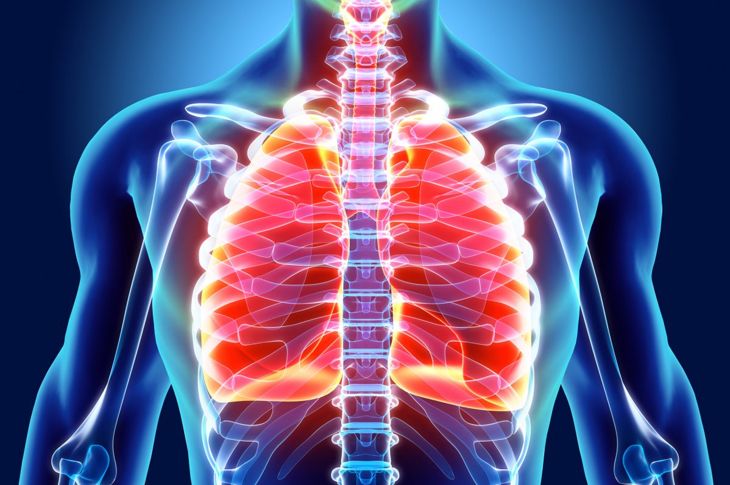 Cosa sono i noduli polmonari? 1
