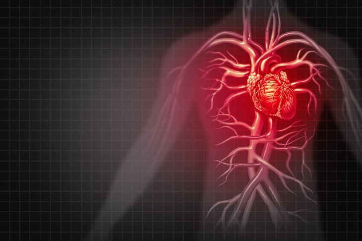10 fatti chiave sulla stenosi aortica 13