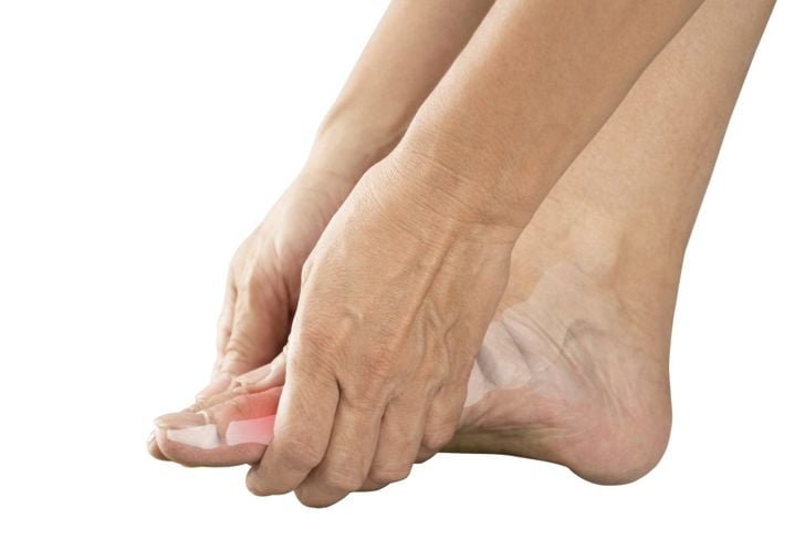 Cose da sapere sulle dita dei piedi rotte 13