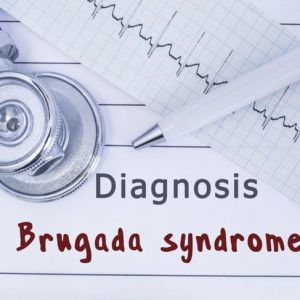 Per saperne di più sulla sindrome di Brugada