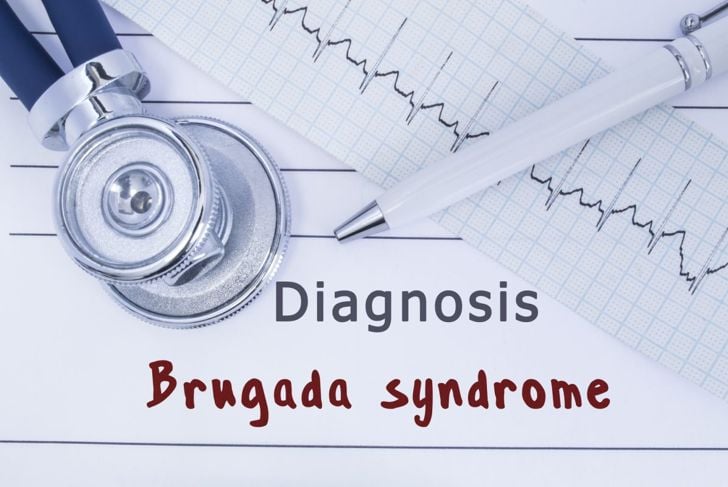 Per saperne di più sulla sindrome di Brugada 1
