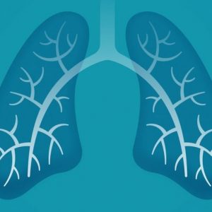 Iperinflazione polmonare: Una complicazione dei disturbi respiratori Iperinflazione polmonare: Una complicazione dei disturbi respiratori