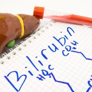 Che cos’è la bilirubina? Che cos’è la bilirubina?