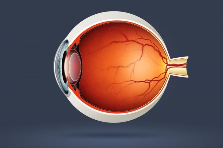 L'uveite è una malattia oculare grave che si maschera da malattia minore 3