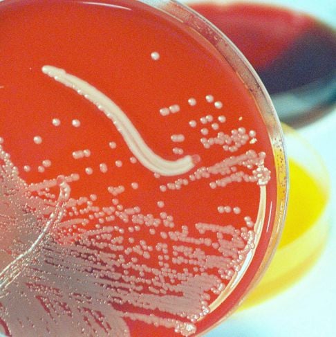 Da lievi a gravi: 10 infezioni batteriche della pelle da conoscere 19