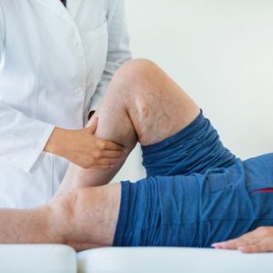 Infiammazione dei vasi sanguigni e poliangioite microscopica Infiammazione dei vasi sanguigni e poliangioite microscopica