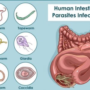 Infezioni da tricocefali: Cause, sintomi e trattamenti Infezioni da tricocefali: Cause, sintomi e trattamenti