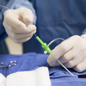 10 fatti sul cateterismo cardiaco 10 fatti sul cateterismo cardiaco